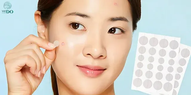Miếng dán mụn là một loại sản phẩm che chắn mụn, có khả năng hút dịch làm khô đầu mụn