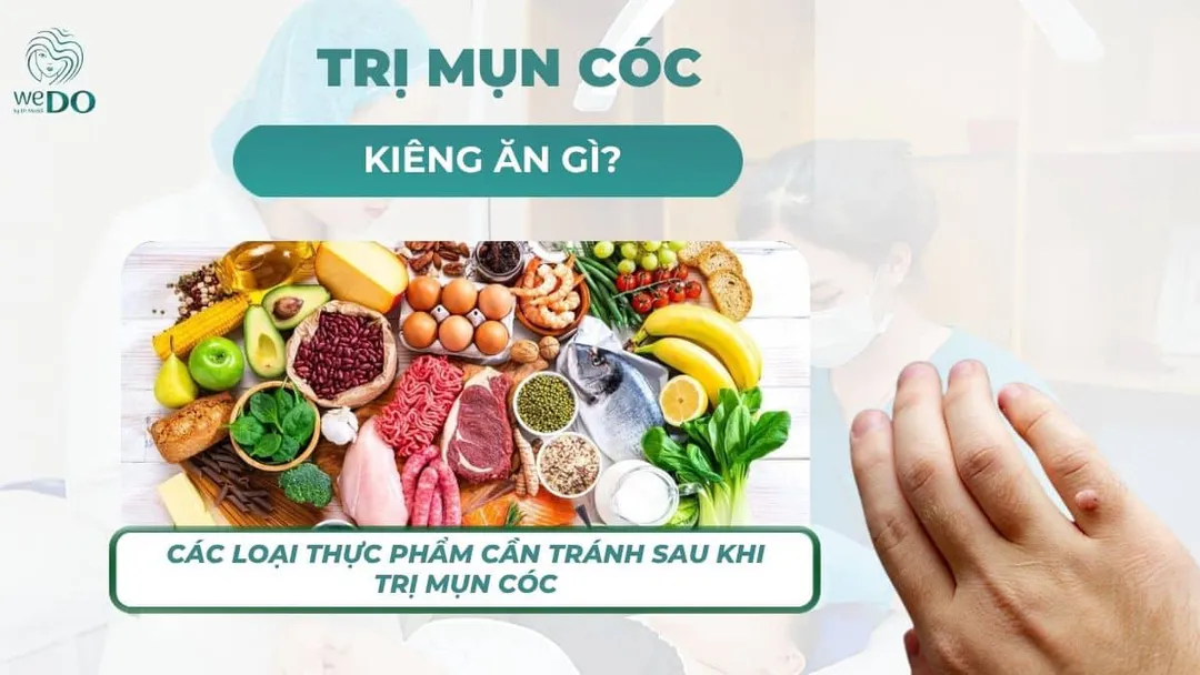 Trị mụn cóc kiêng ăn gì? Chế độ dinh dưỡng hỗ trợ trị mụn cóc