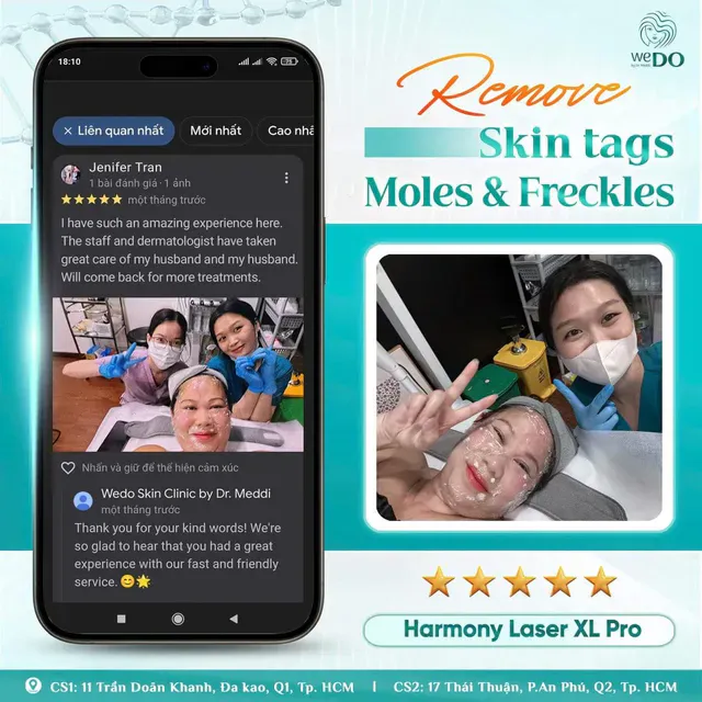 Remove moles, skin tags, and pigmentation—painlessly and effortlessly.