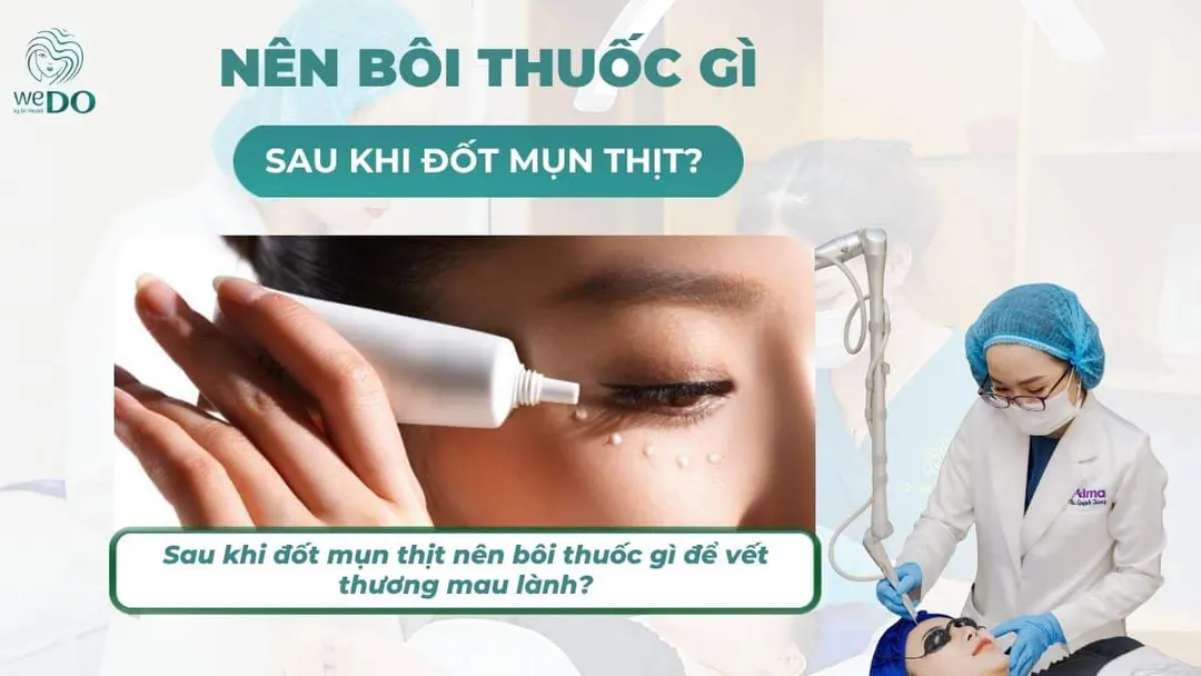Sau khi đốt mụn thịt nên bôi thuốc gì để vết thương mau lành?