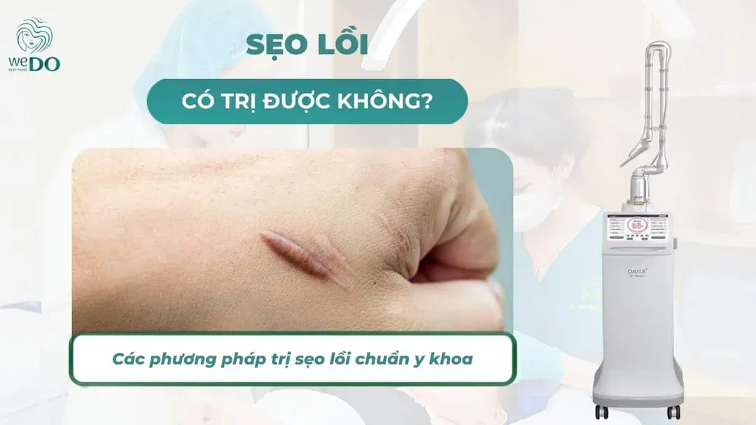 Sẹo lồi có trị được không? Các phương pháp trị sẹo lồi chuẩn y khoa