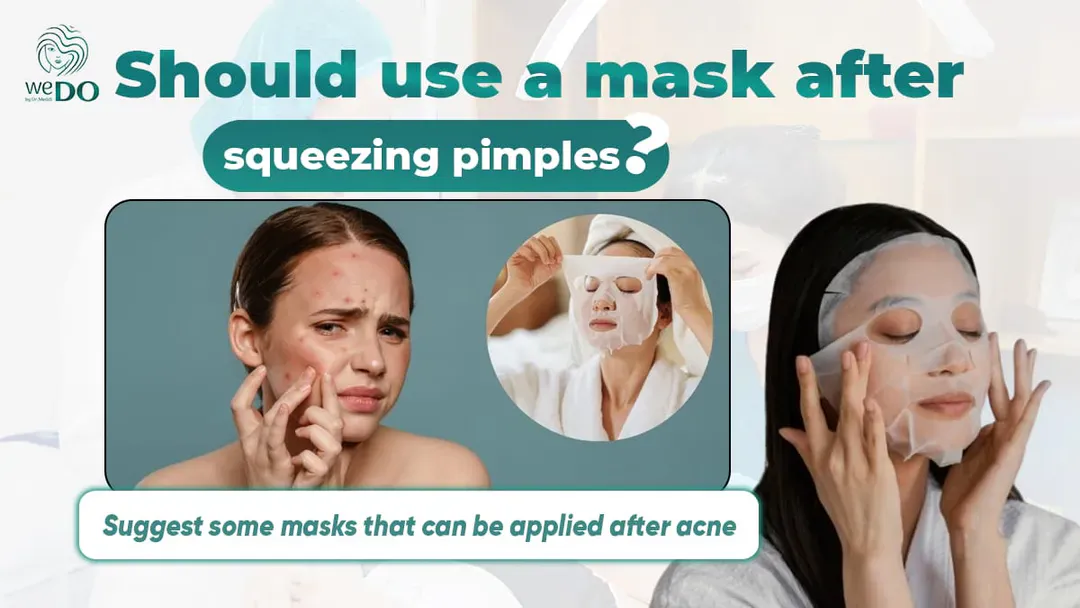 Should use a mask after squeezing pimples?