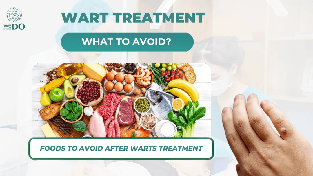 What foods should you avoid when treating warts? Nutritional regimen to support wart treatment