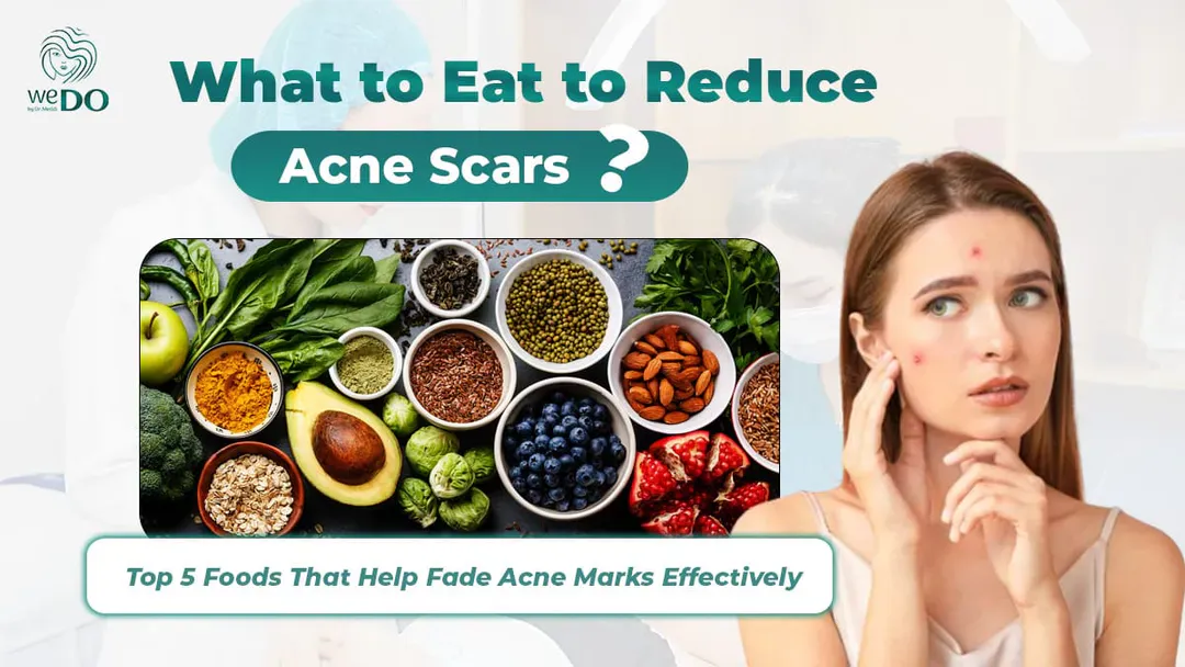 What to eat to reduce acne scars? Top 5 foods that help fade acne scars effectively
