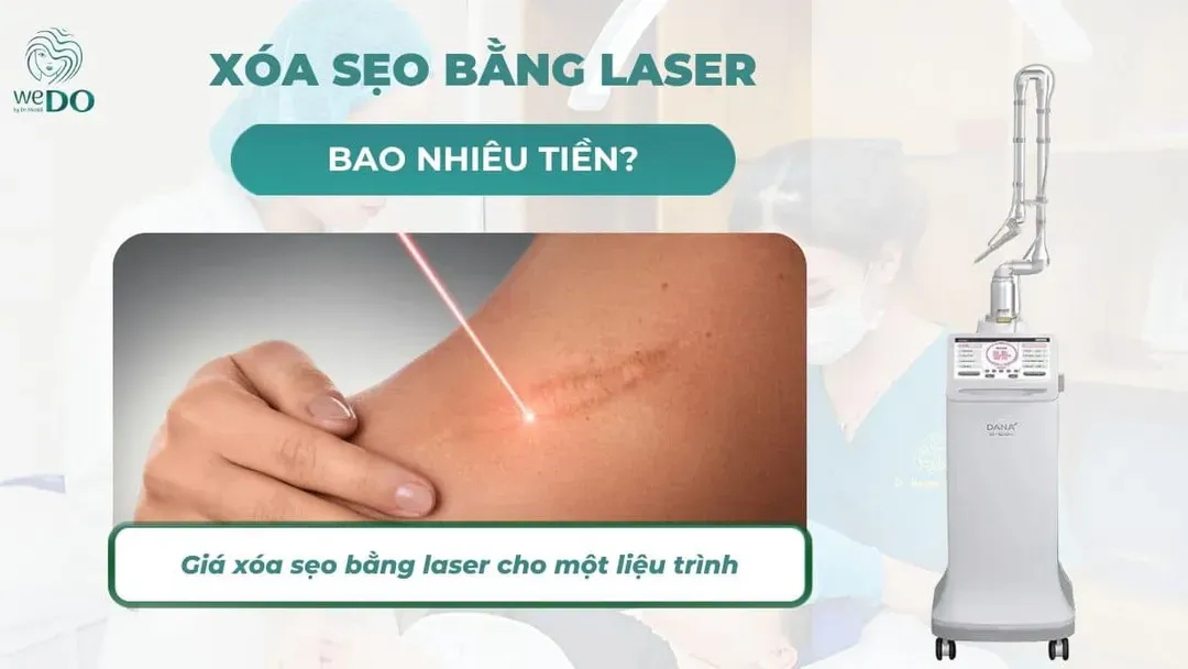 Xóa sẹo bằng laser bao nhiêu tiền cho một liệu trình?