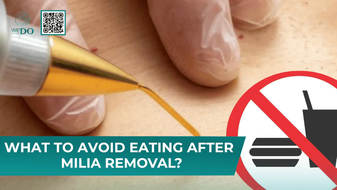 WHAT TO AVOID EATING AFTER MILIA REMOVAL