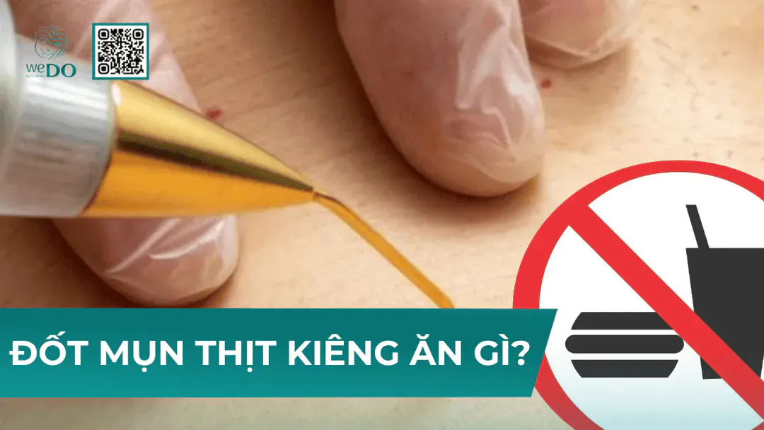 Đốt mụn thịt kiêng ăn gì để không bị sẹo?