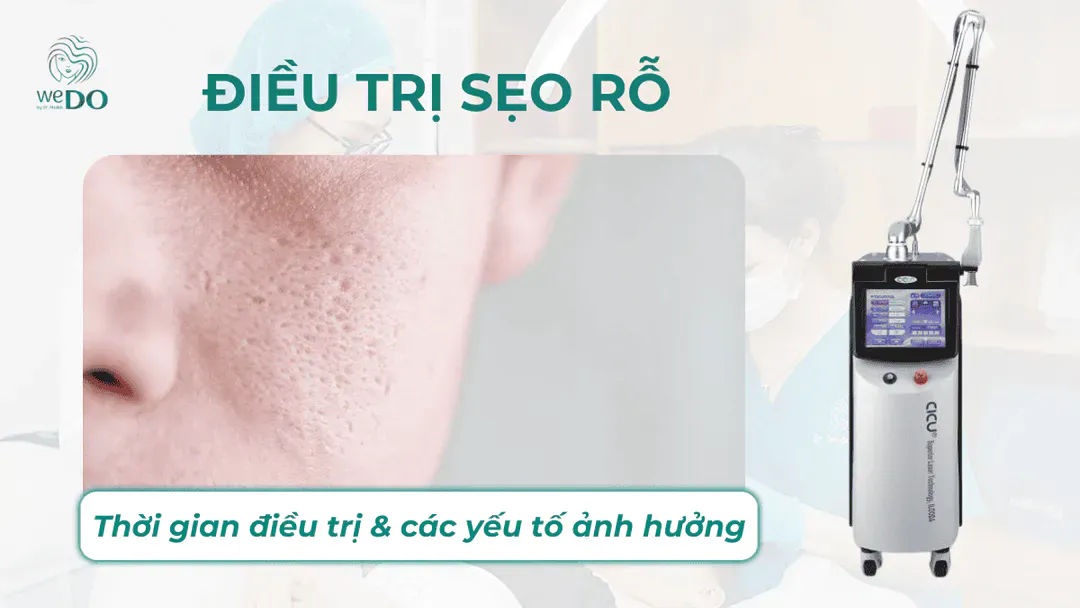 Liệu trình trị sẹo rỗ mất bao lâu? Các yếu tố ảnh hưởng thời gian điều trị