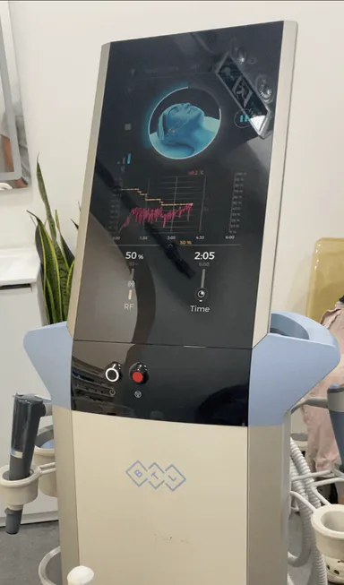 RF Microneedling in HCMC: Morpheus8, Potenza, Exion, Virtue RF and EndyMED