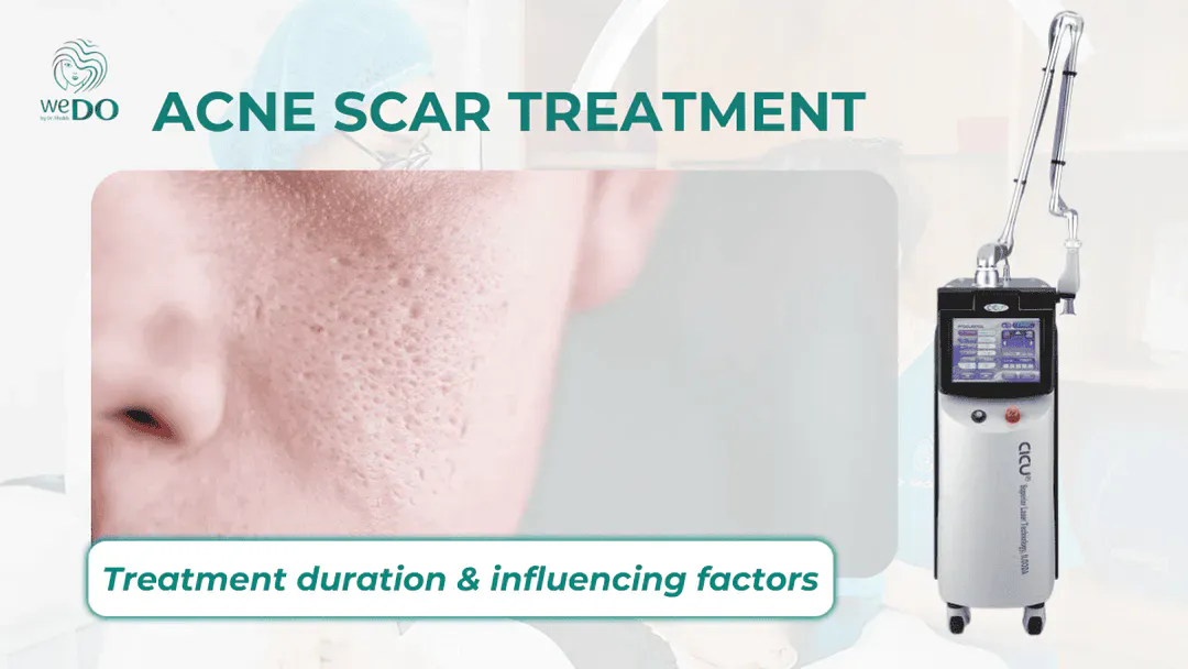 How long does acne scar treatment take? Factors influencing treatment duration