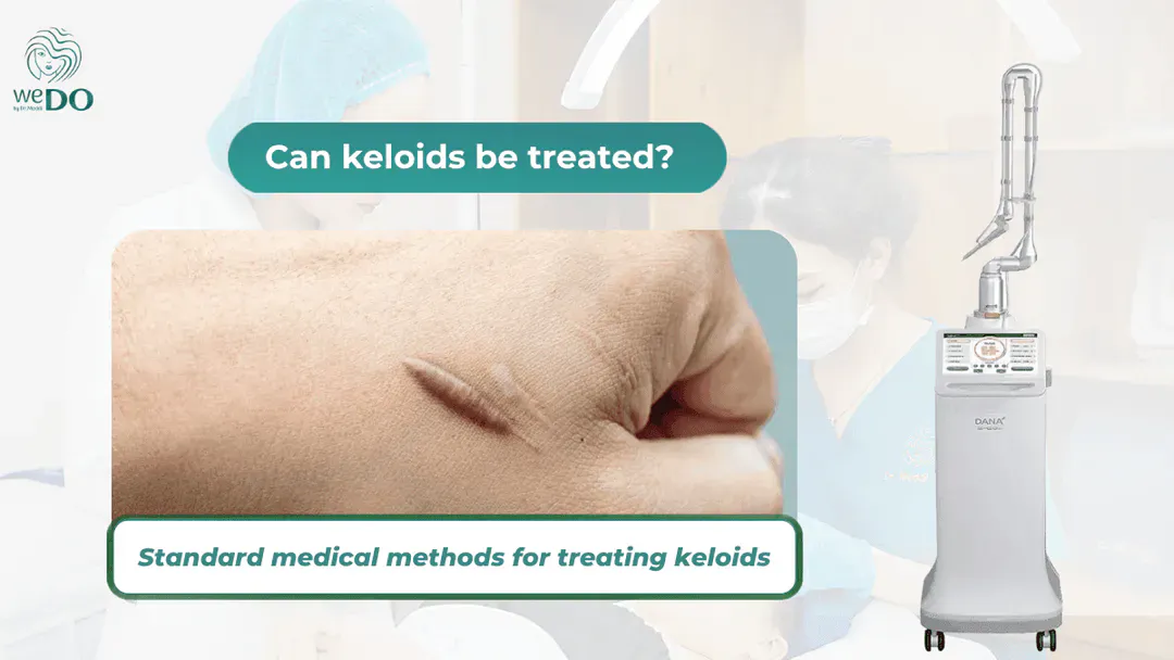 Can keloids be treated? Standard medical methods for treating keloids