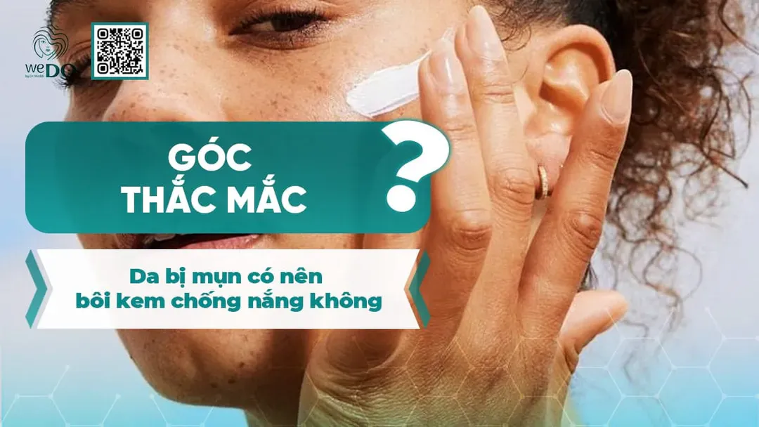 Góc giải đáp: Da bị mụn có nên bôi kem chống nắng không?