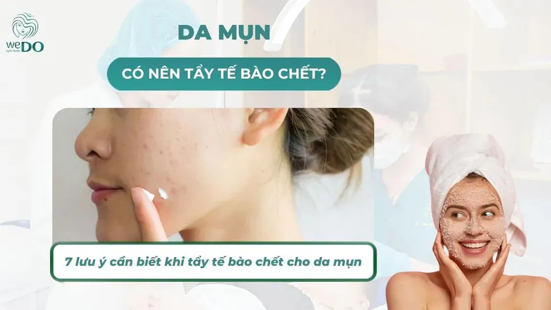 Da mụn có nên tẩy tế bào chết hay không? 7 lưu ý cần nhớ