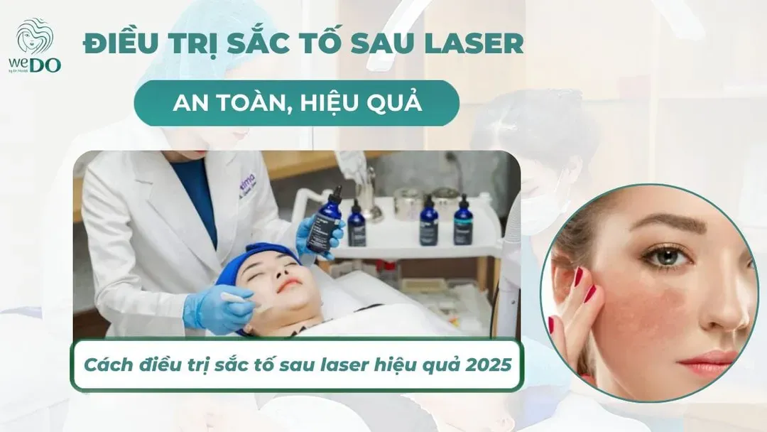 Cách điều trị sắc tố da sau laser an toàn, hiệu quả