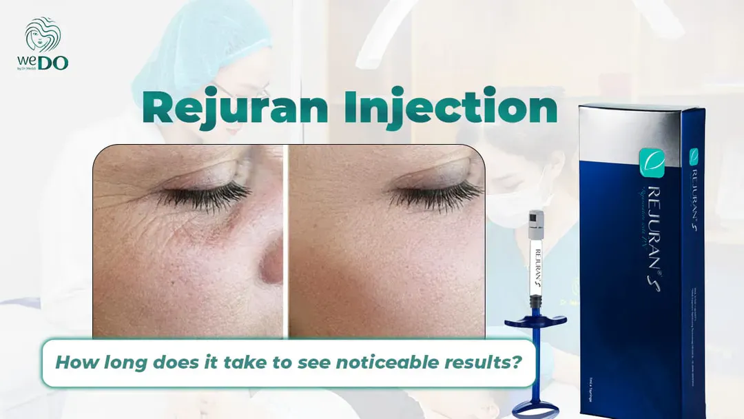 How Long Does It Take for Rejuran to Show Visible Results?
