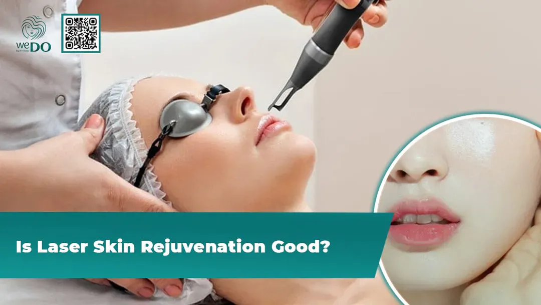 Is Laser Skin Rejuvenation Good?