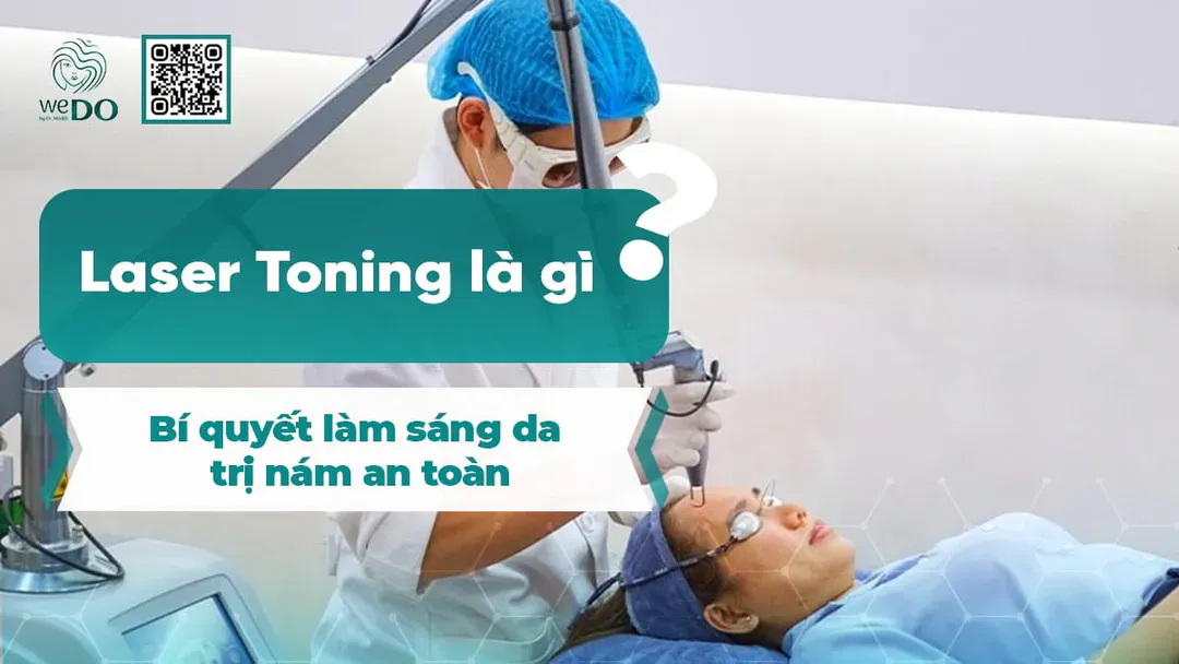 Laser Toning là gì? Bí quyết làm sáng da, trị nám an toàn