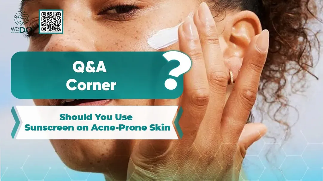 Q&A Corner: Should You Use Sunscreen on Acne Prone Skin?