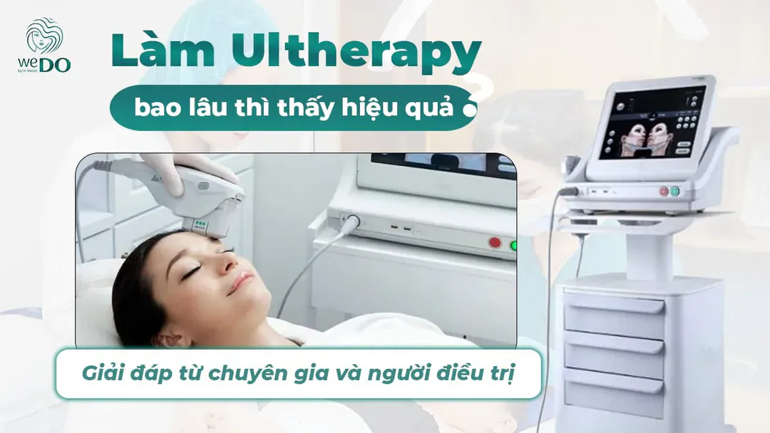Làm trẻ hóa da Ultherapy bao lâu thì thấy hiệu quả?