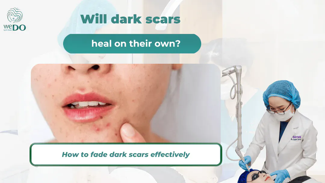Will dark scars heal on their own? How to fade dark scars effectively