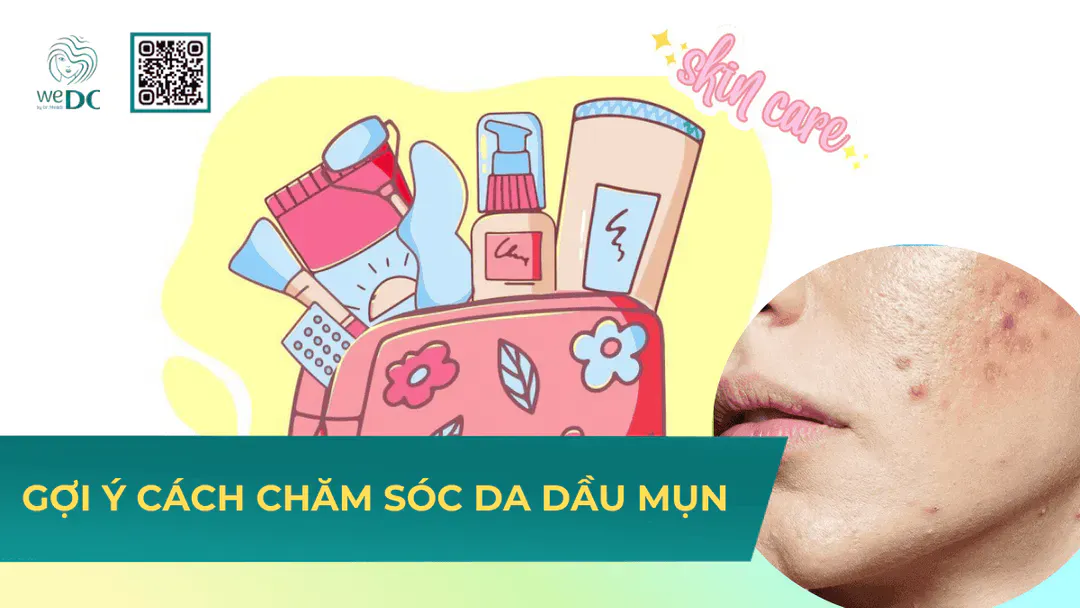 Gợi ý chăm sóc da dầu mụn để kiểm soát dầu thừa