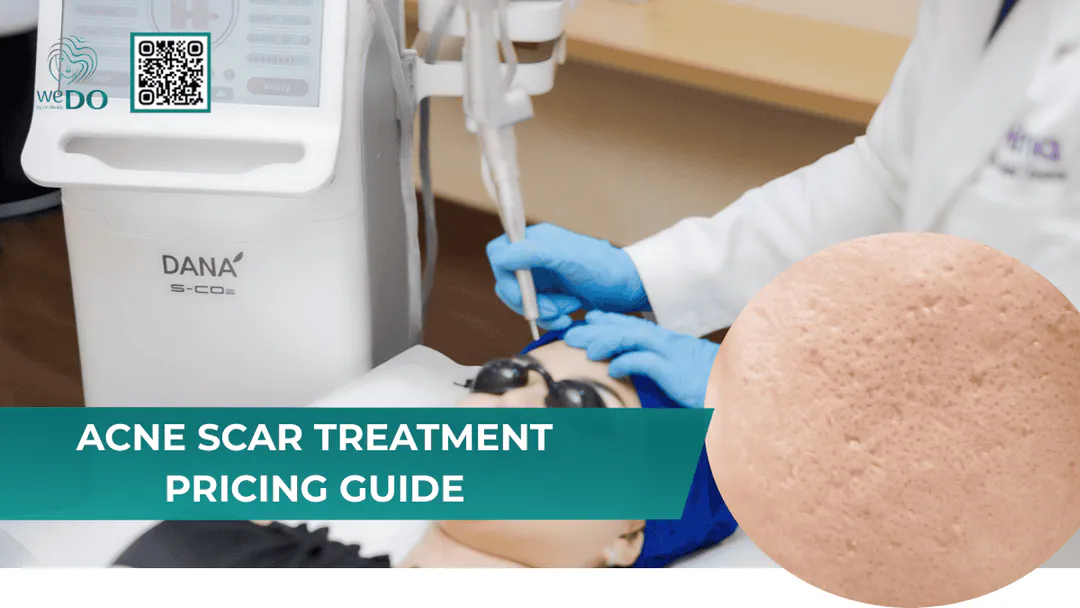 How Much Does Acne Scar Treatment Cost?