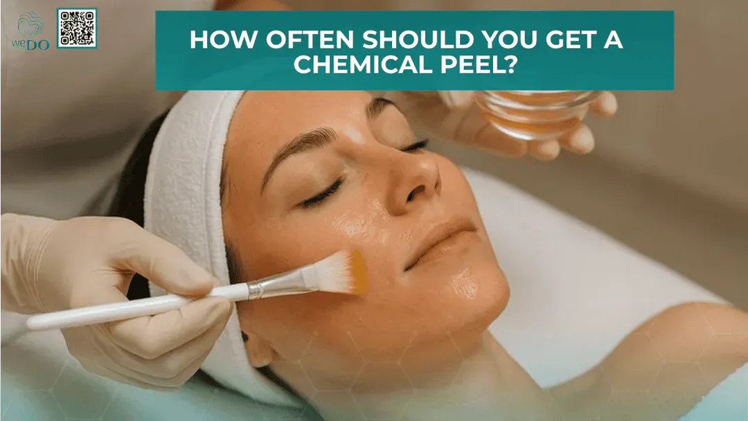 HOW OFTEN SHOULD YOU GET A CHEMICAL PEEL?
