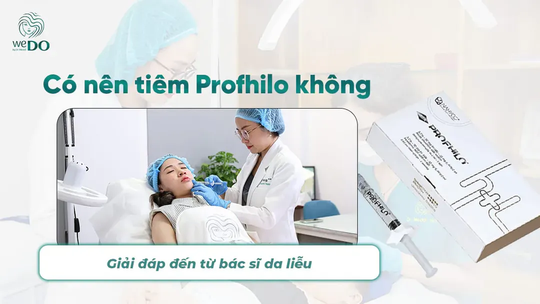 Có nên tiêm Profhilo không?