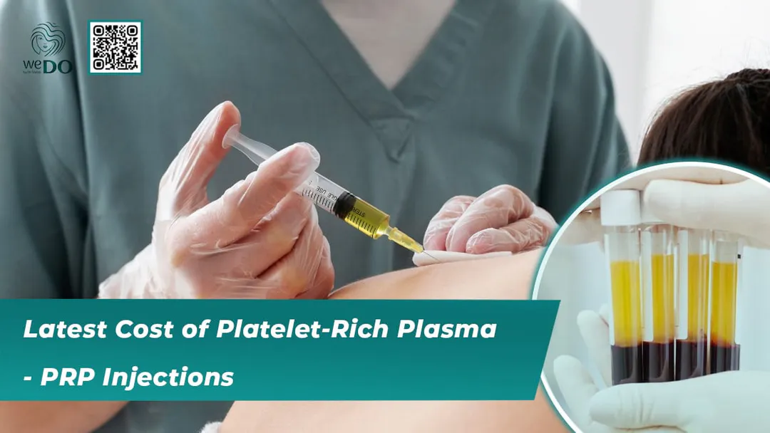 Latest Cost of Platelet-Rich Plasma – PRP Injections