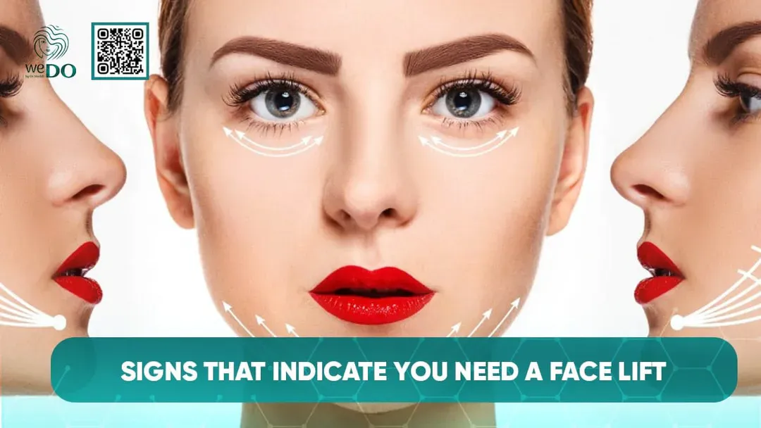 Signs That Indicate You Need a Face lift