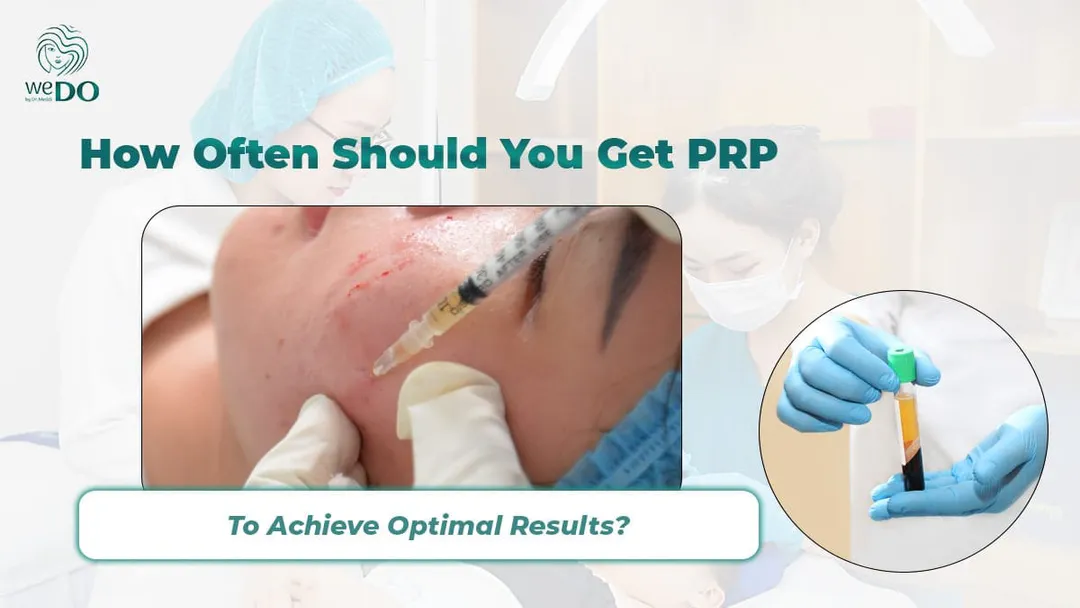How Often Should You Get PRP to Achieve Optimal Results?