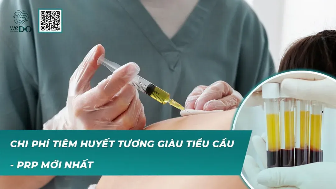 Chi phí tiêm huyết tương giàu tiểu cầu – PRP mới nhất