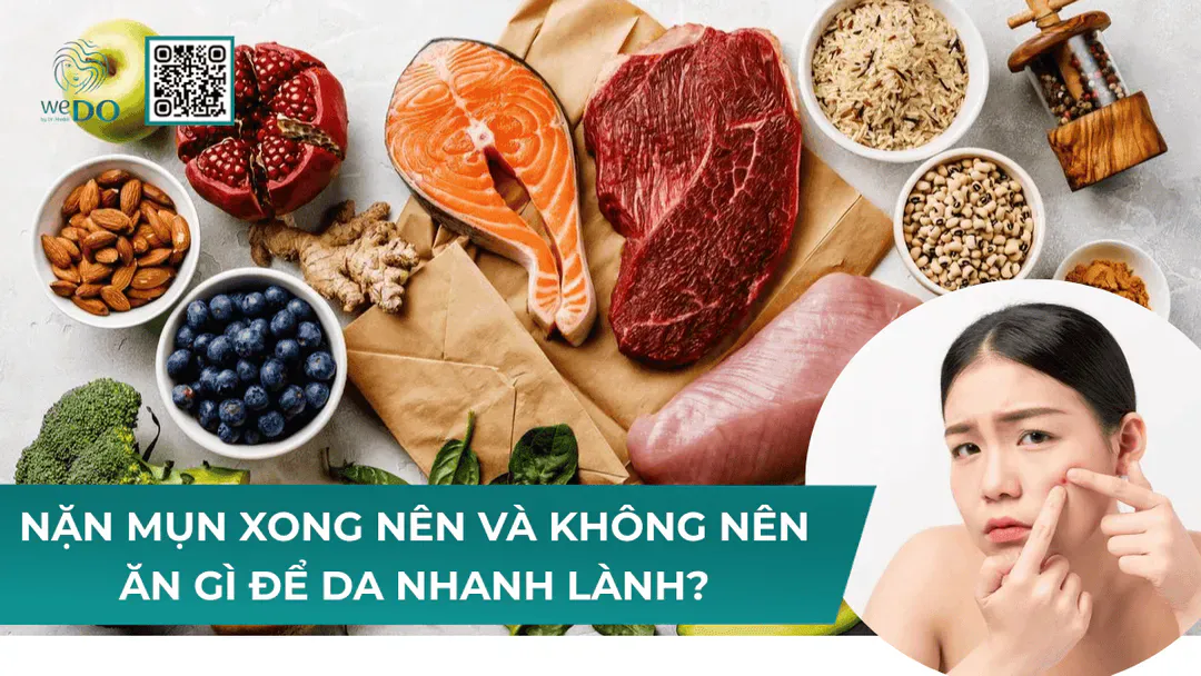 Sau khi nặn mụn nên và không nên ăn gì?