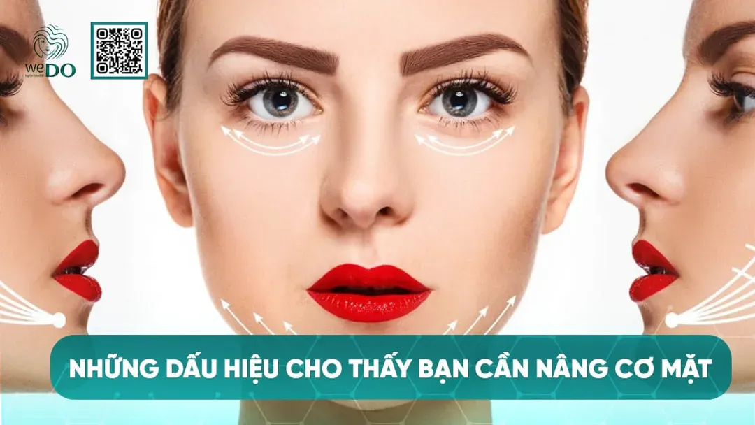 Những dấu hiệu cho thấy bạn cần nâng cơ mặt
