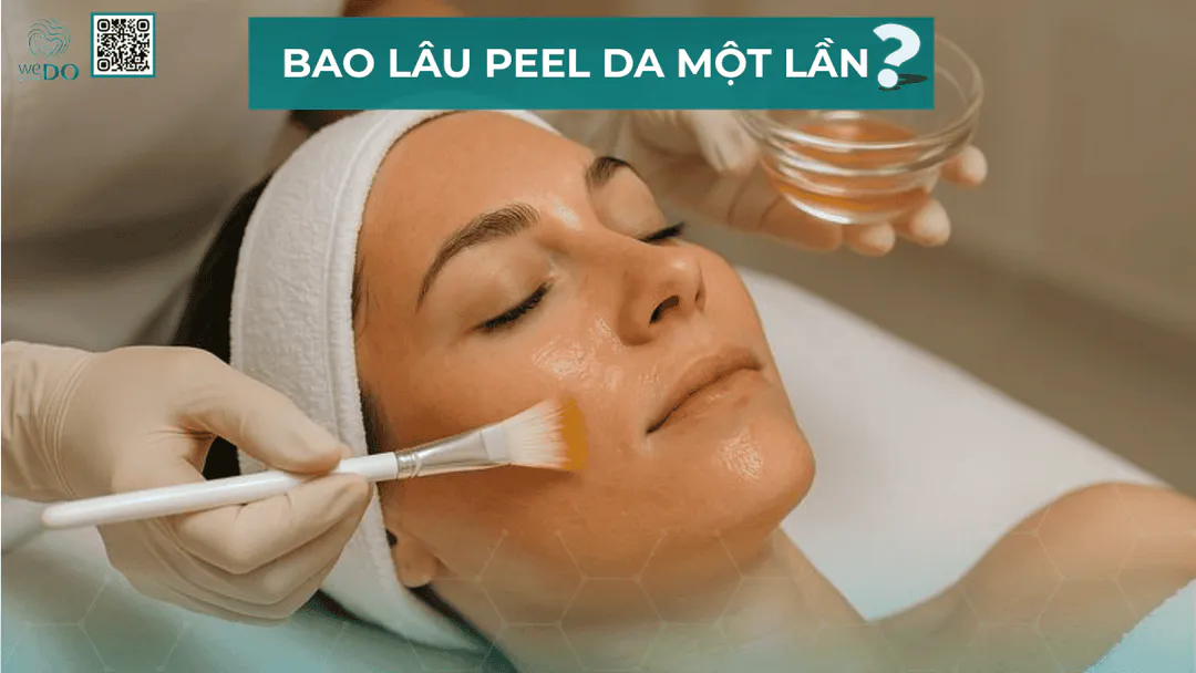 Nên peel da bao lâu một lần? Tần suất peel da an toàn