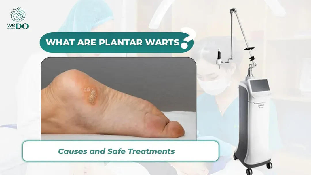 What Are Plantar Warts? Causes and Safe Treatments