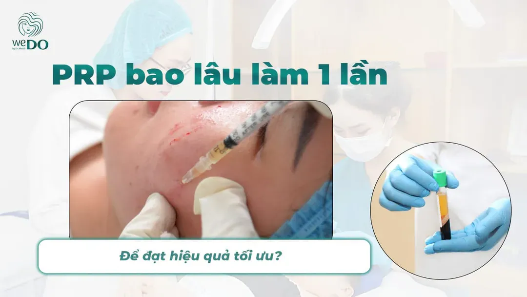PRP bao lâu làm 1 lần để đạt hiệu quả tối ưu?
