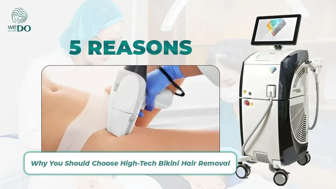 5 Reasons Why You Should Choose High-Tech Bikini Hair Removal