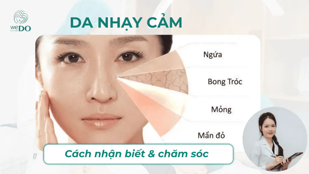 Cách nhận biết và chăm sóc da nhạy cảm