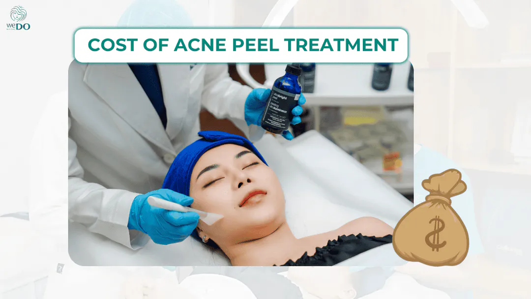 Acne Peel Cost and Safe Clinics in Ho Chi Minh City