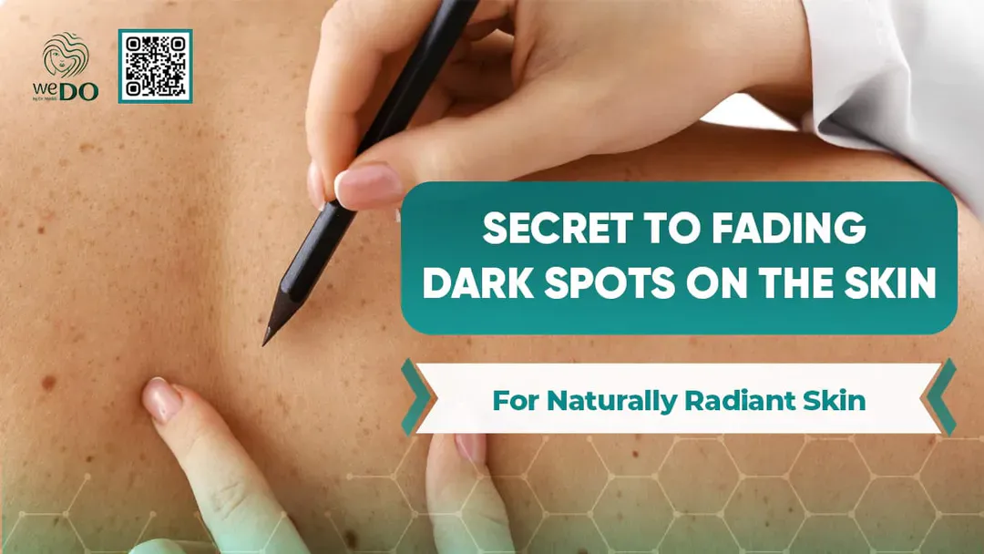 Secret to Fading Dark Spots on the skin for Naturally Radiant Skin