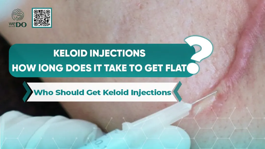 How Long Does It Take for Keloid Injections to Flatten? Who Should Get Keloid Injections?