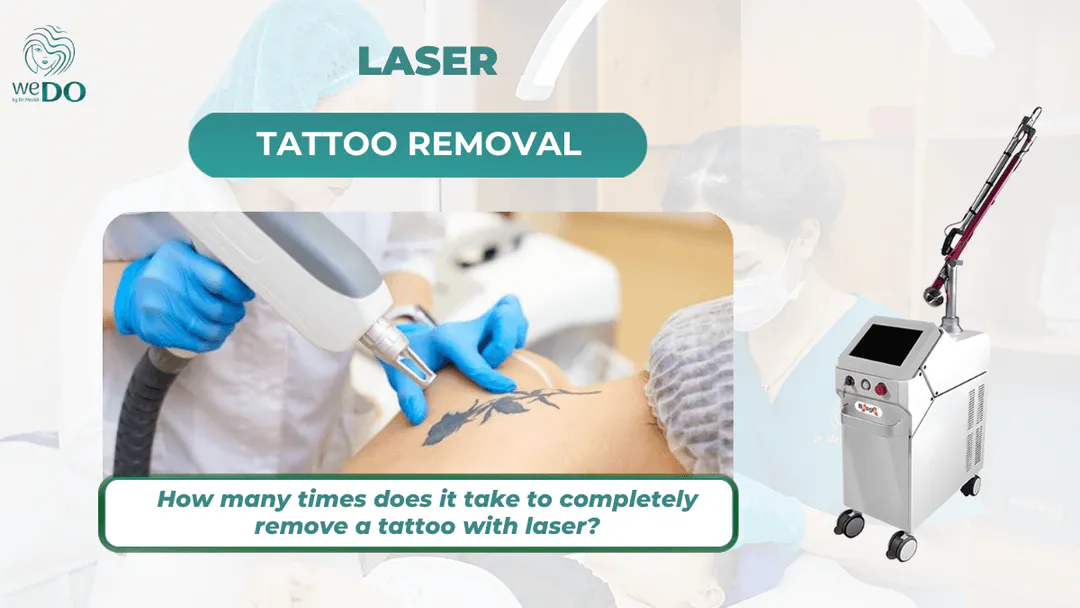 How many laser tattoo removal sessions are needed to completely remove a tattoo? How long does the procedure last?