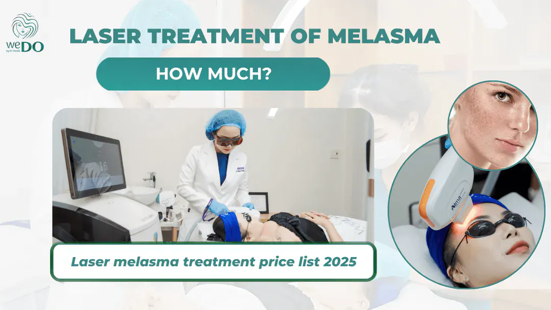How much does laser treatment for melasma cost? Laser melasma treatment price list 2026