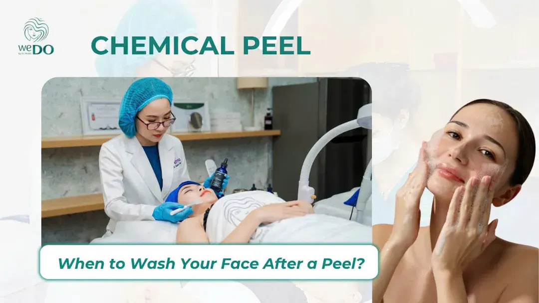 When Is It Safe to Wash Your Face After a Chemical Peel?