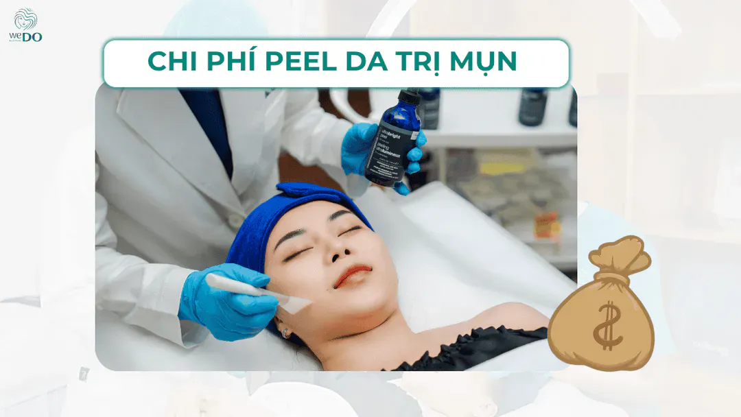 Peel da trị mụn giá bao nhiêu? Địa chỉ peel da an toàn tại TP HCM