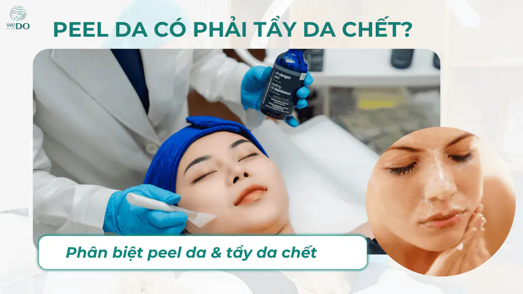 Peel da có phải tẩy da chết không?
