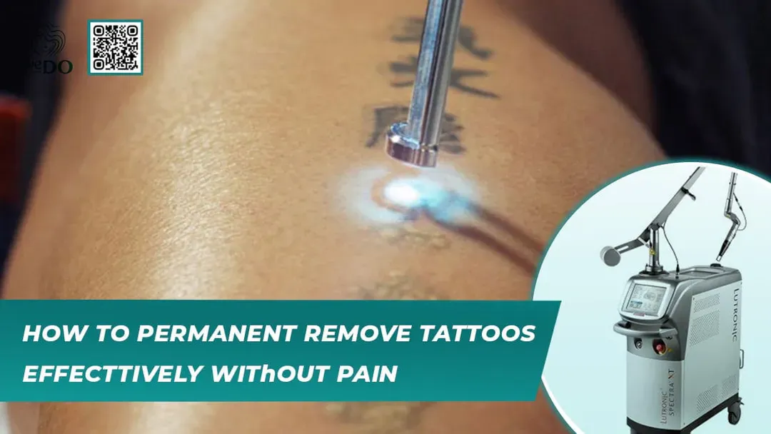 How to Permanent Remove Tattoos Effectively Without Pain