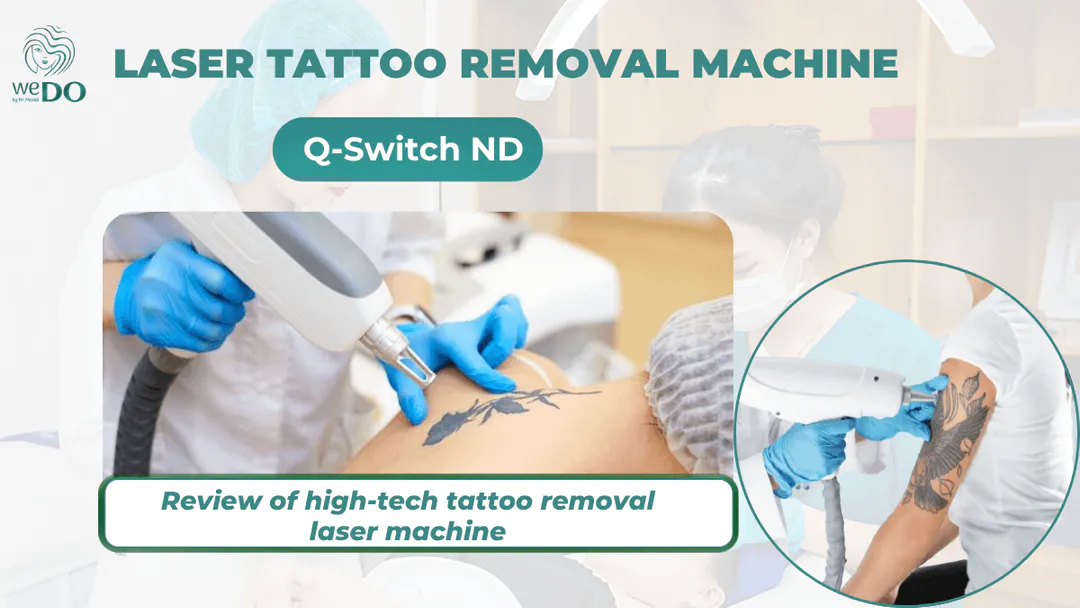 Review of high-tech Q-Switch ND tattoo removal laser machine