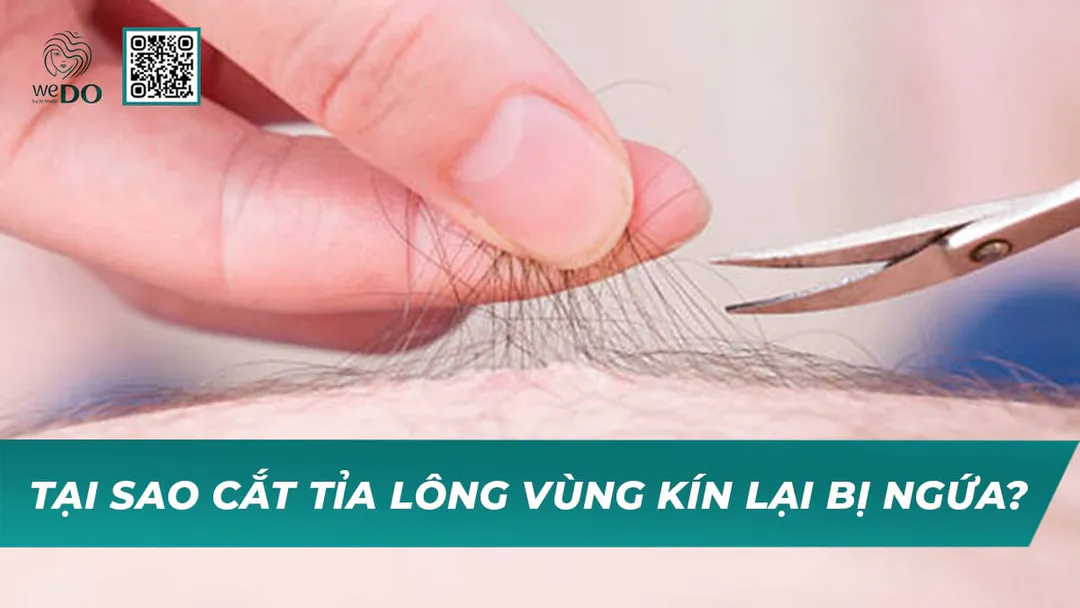 Tại sao cắt tỉa lông vùng kín lại bị ngứa?